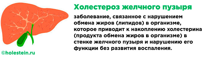 Холестероз желчного пузыря (липоидоз): что это такое, диагностика, виды лечения 