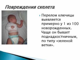 Чем грозит перелом ключицы у новорожденного 