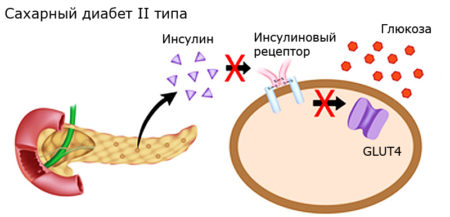 Можно, но не все: какие сухофрукты полезно есть при диабете 1 и 2 типа, а какие — нет? 