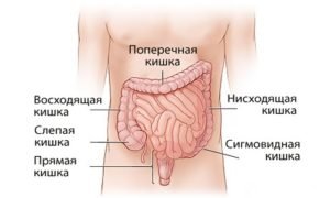 Рак сигмовидной кишки — симптомы, стадии и лечение заболевания 