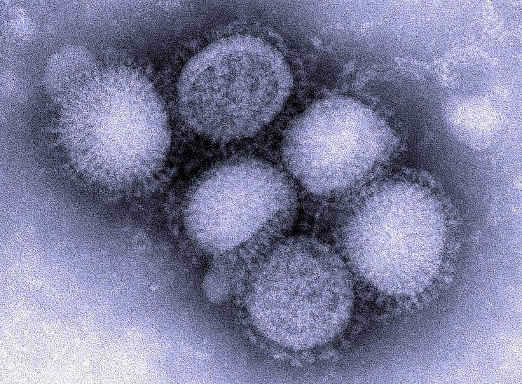 Симптомы и лечение свиного гриппа H1N1 