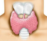 Аутоиммунный тиреоидит: лечение, симптомы, причины 