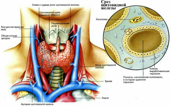 Аутоиммунный зоб: особенности течения загадочной болезни 