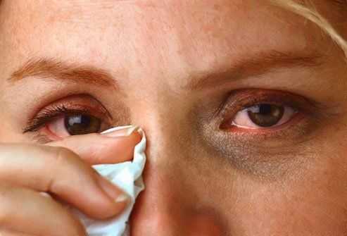 Неприятное жжение в глазах — причины и лечение 