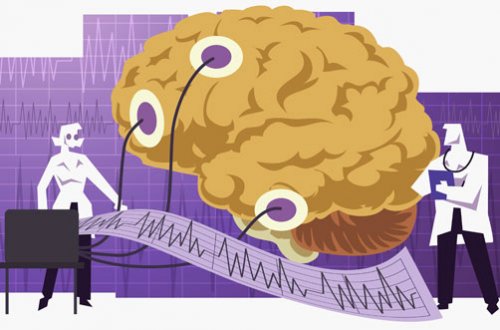 Электрическая активность мозга 