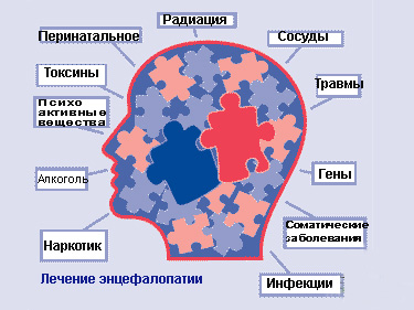 Как лечить энцефалопатию головного мозга 