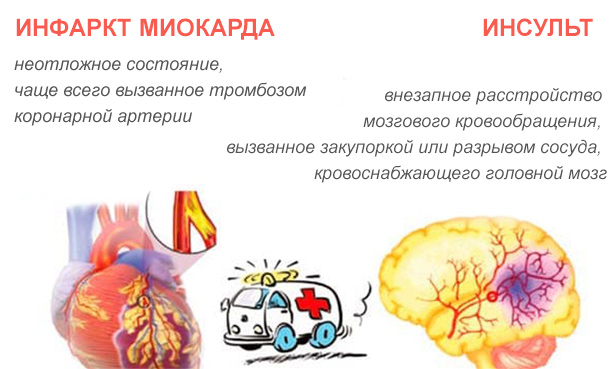 Инсульт различия. Разница между инсультом и инфарктом головного мозга. Инфаркт головного мозга и инсульт разница. Отличие инфаркта миокарда от инсульта. Инфаркт и инсульт разница мозга мозга.