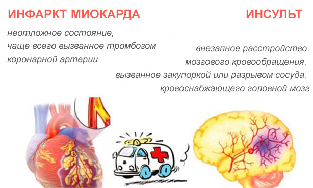 Отличие инфаркта от инсульта - причины возникновения и схожие симптомы, диагностика, методы лечения 