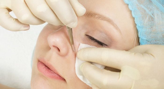 Аппаратная чистка кожи лица: виды и особенности процедуры 