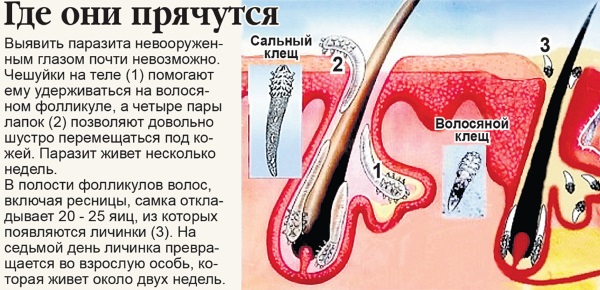 Азелаиновая кислота: применение в косметологии 