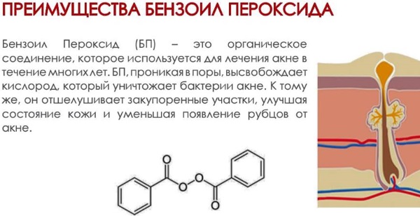 Бензоил пероксид от прыщей 