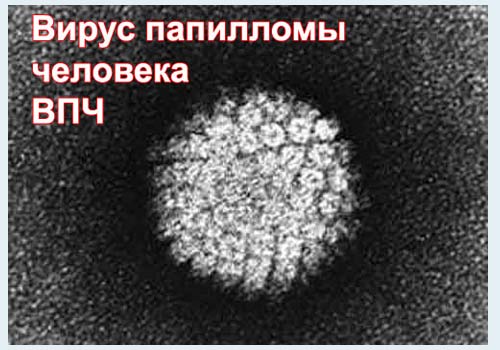 Бородавки нитевидные – и вновь ВПЧ, а это опасно? 