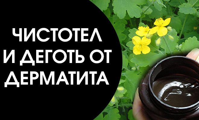 Деготь и чистотел для борьбы с дерматитом 