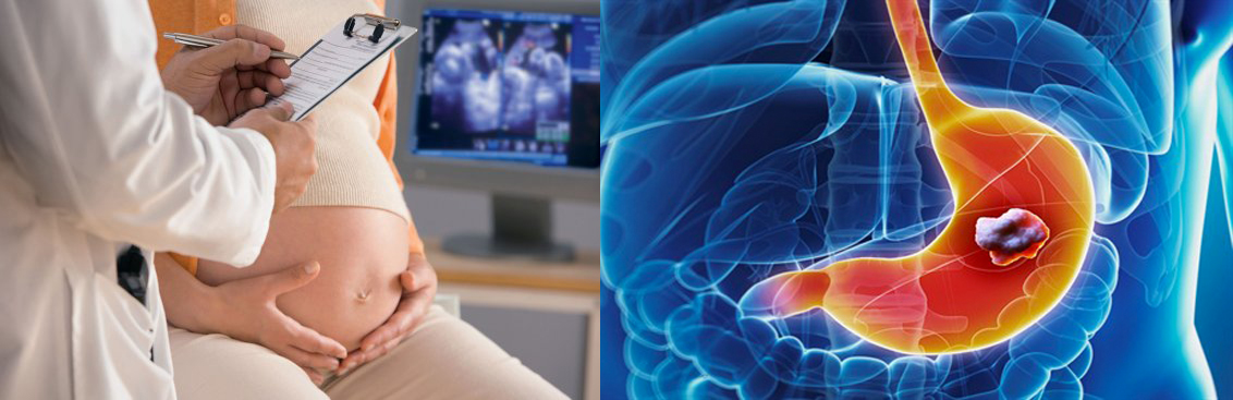 Диагностика гастрита при беременности, профилактические меры 