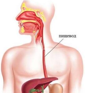 Признаки и лечение ожога пищевода и глотки 