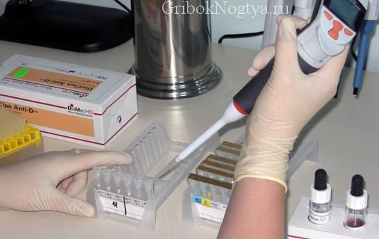 Как проводится анализ на грибковую инфекцию ногтей 