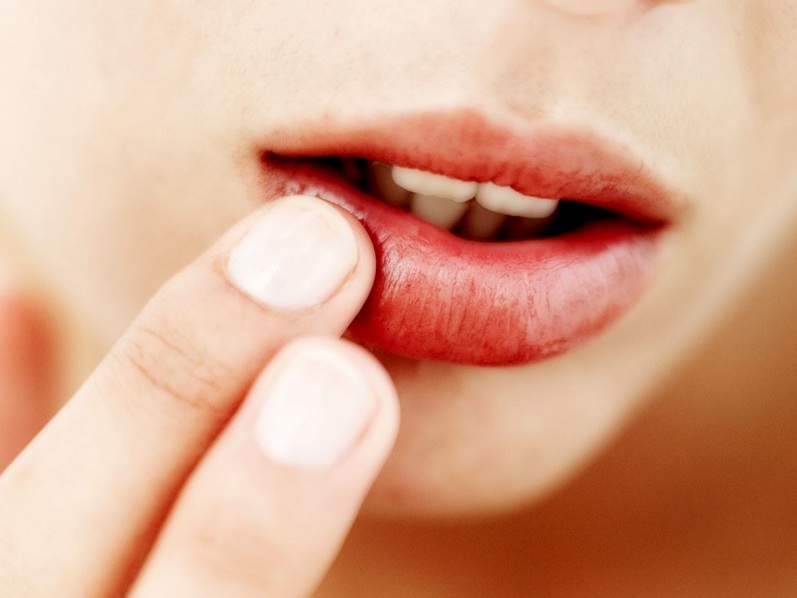Как лечится папиллома на губе? 