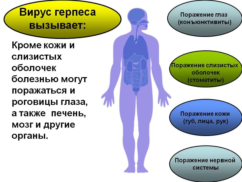 Как справиться с рецидивирующим гepпeсом? 