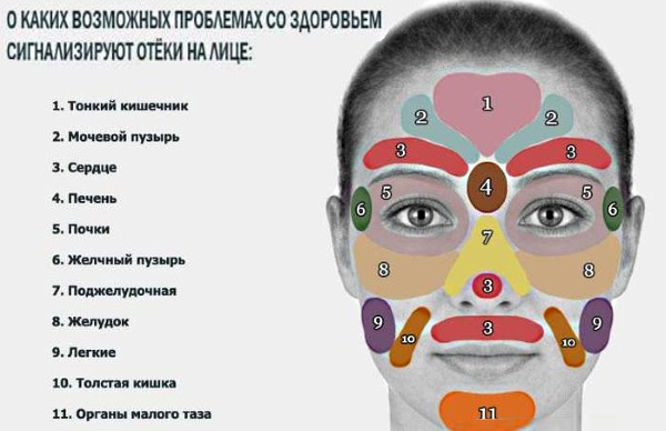 Как убрать отечность под глазами 