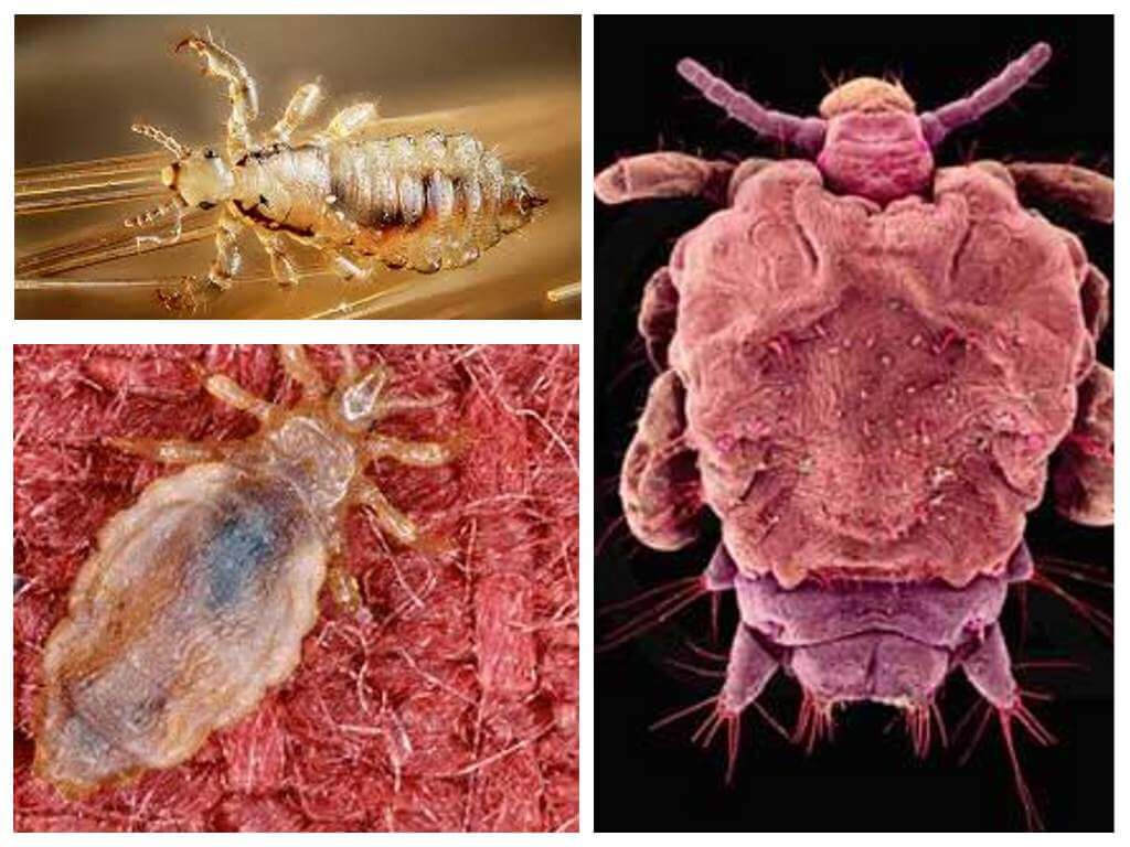 Кто такие подкожные вши и как с ними бороться 