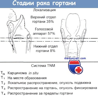 Какие операции проводятся при paке гортани 