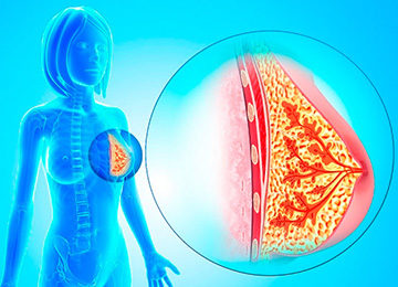 Коварная и опасная — болезнь Минца молочной железы 