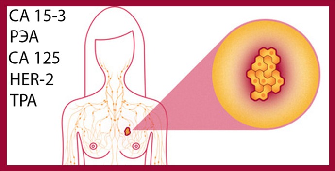Онкомаркеры при paке гpyди 