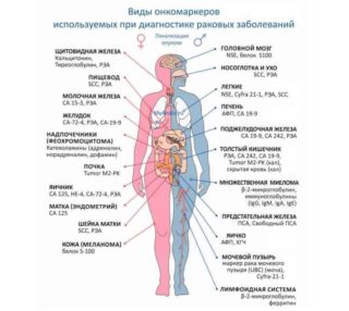 Опухолевые маркеры молочной железы 