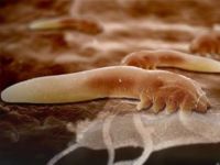 Какие паразиты живут в печени человека и как от них избавиться 