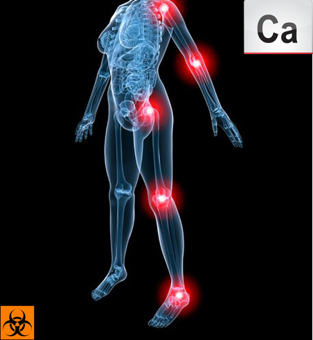 Переизбыток кальция в организме и способы его снижения 