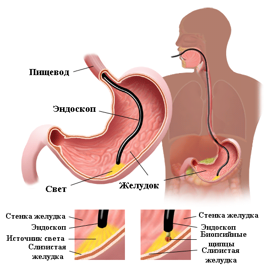 Где можно сделать платно фгс в калининграде? 