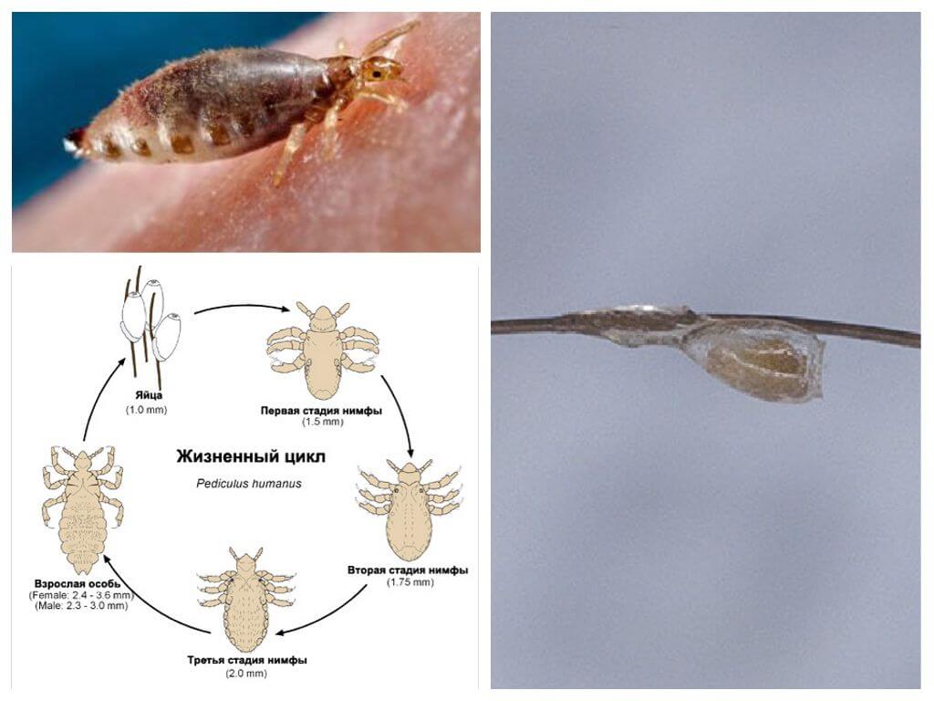 Как быстро размножаются вши на голове у человека 