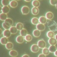 Mycoplasma hominis — что это за микроорганизм 