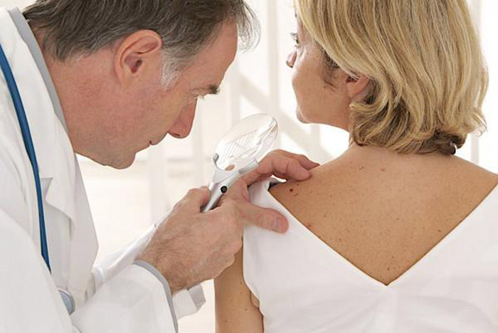 Папилломы на шее — рассказывает врач-дерматолог 