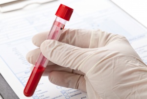 Анализ крови на описторхоз — подготовка, процедура, расшифровка и лечение паразитарного заболевания 