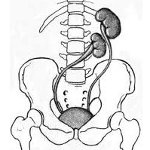Аномальное расположение парного органа — дистопия почки: причины развития аномалии и правила терапии недуга 