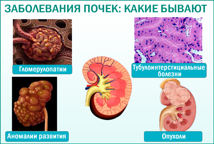 Антибиотики для почек при их воспалении 