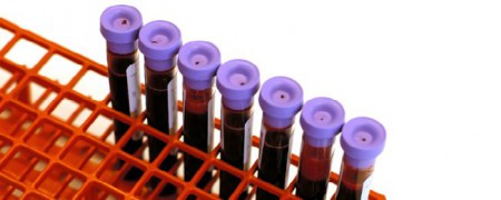 Применяемые методы анализов крови на коклюш и их результативность 