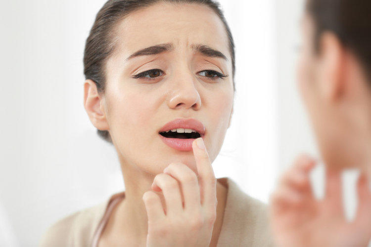 Как лечить герпес на губах 