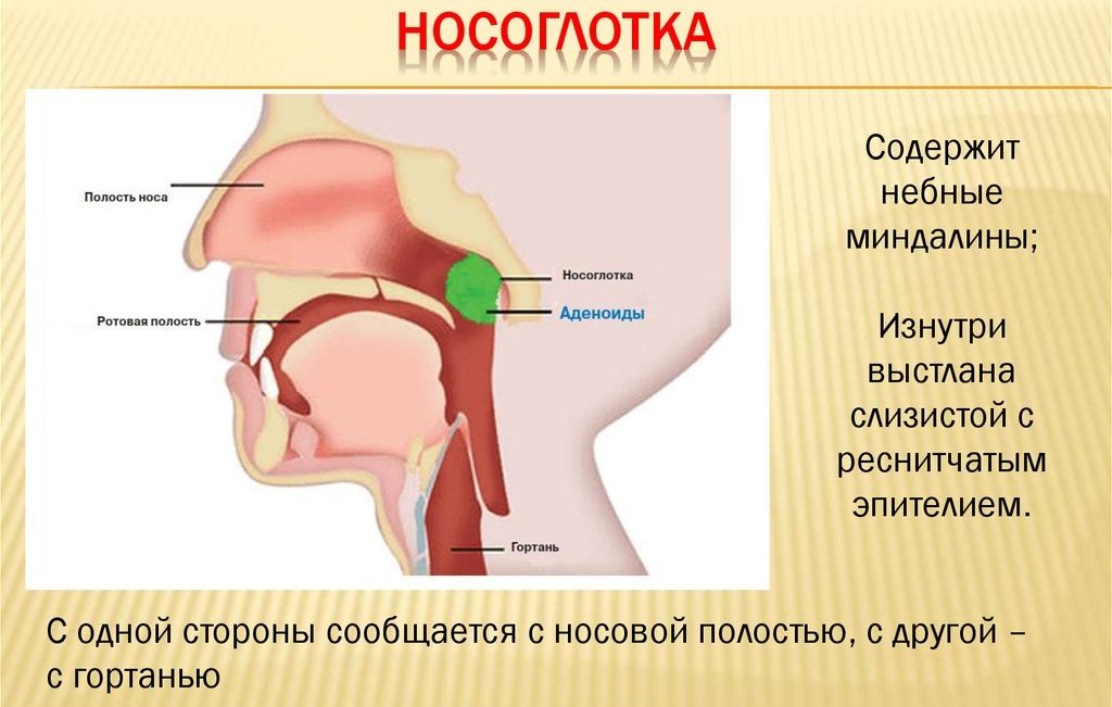 Аденоиды у детей. Симптомы и лечение аденоидов у ребенка 