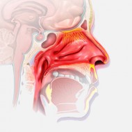 Атрофический ринит: причины, признаки, как лечить 
