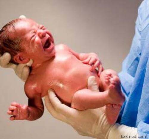 Что делать если не раскрылись лёгкие у младенца? (ателектаз) 