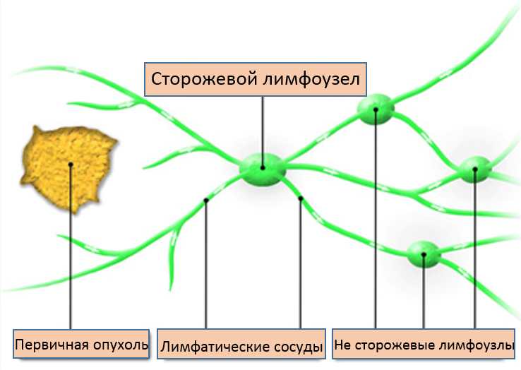 Как берут биопсию легких: виды, последствия, результаты, отзывы и цены 