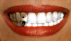 Как отбелить зубы в домашних условиях: простые и доступные способы 