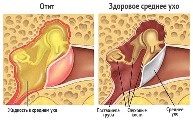 Как принимать капли «Ниотит»? 