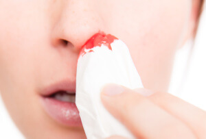 Кровь из носа во время беременности — причины кровотечений в первом, втором, третьем триместре 
