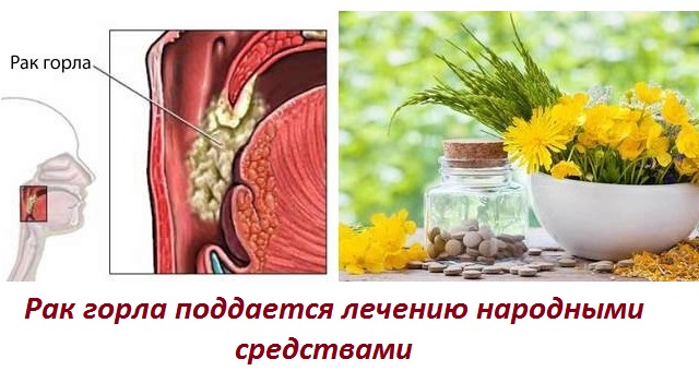 Лечение paка горла народными средствами 