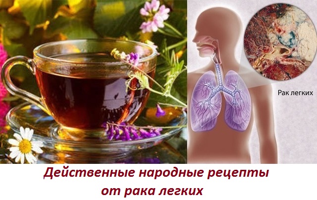 Лечение paка легких народными средствами, самые эффективные 