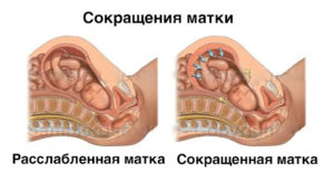 Как повысить тонус матки: препараты, рецепты, продукты 