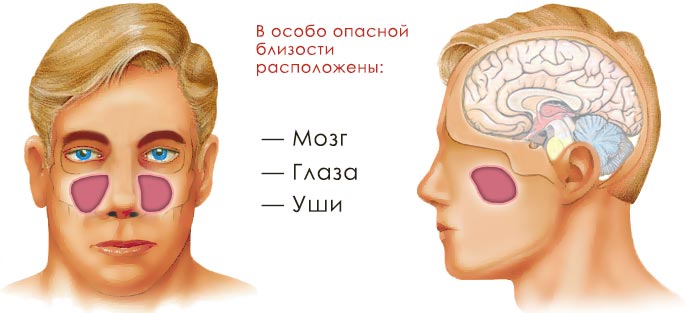 Почему нельзя запускать гайморит: немного о последствиях 